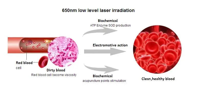 Opslea Csukló Laser Terápia