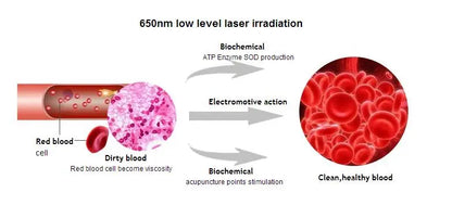 Opslea Csukló Laser Terápia
