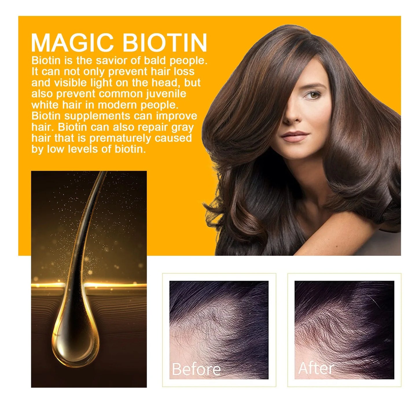 Biotin Hajolaj Eelhoe Növelés