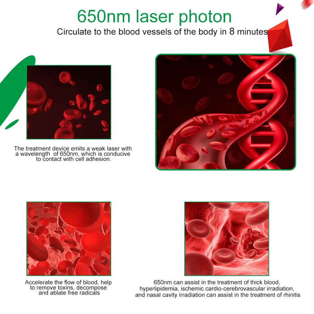 Opslea 650nm Lézer Terápia