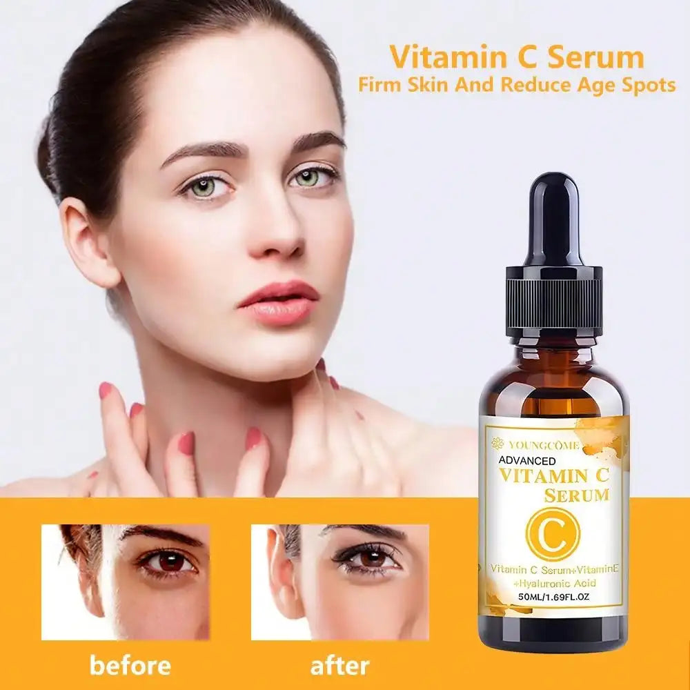 Youngcome Vitamin C Szérum